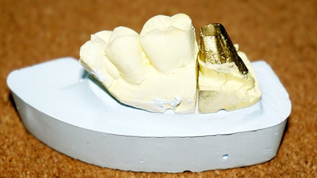 作りかけの入れ歯の模型